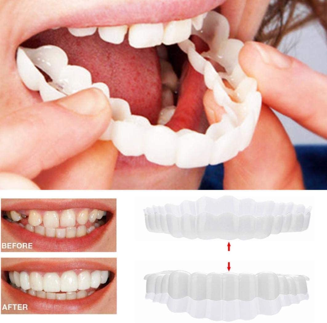 Instant Smile Veneers – Upper & Lower Clip-On Dental Veneer Set