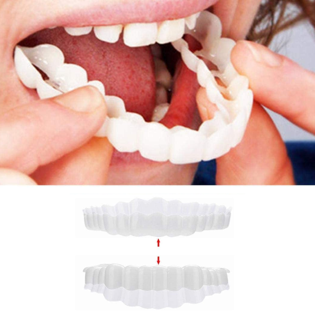 Instant Smile Veneers – Upper & Lower Clip-On Dental Veneer Set