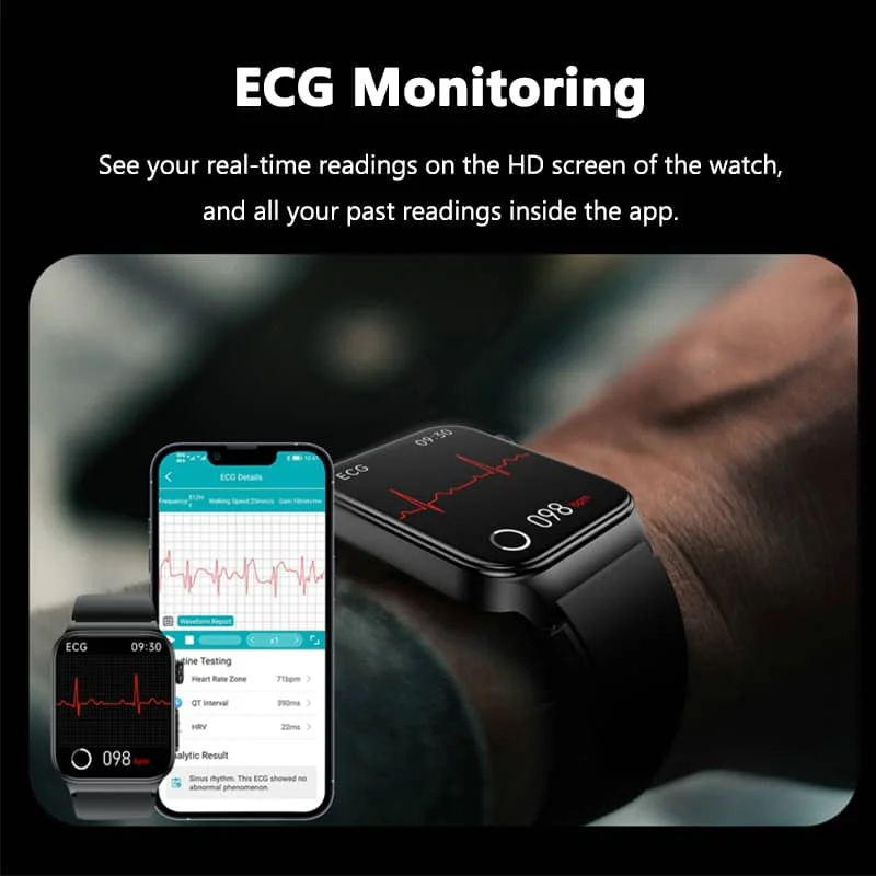 ECG Smartwatch – Blood Pressure, Glucose, Body Temp & Heart Rate Monitor